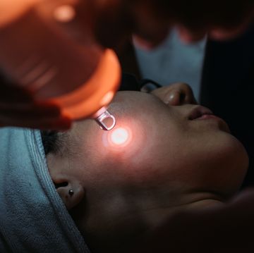 ultraclear why cold lasers are the hottest new skin treatment