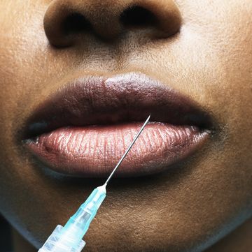 woman receiving injection in lip, close up